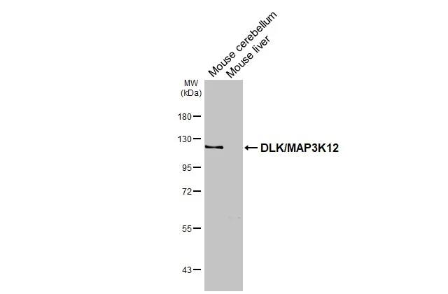Anti-DLK/MAP3K12 antibody (GTX124127) | GeneTex