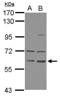 Sample (30 ug of whole cell lysate) A: Juakar B: K562 7.5% SDS PAGE GTX124169 diluted at 1:5000 