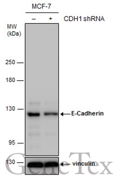Non-transfected (–) and transfected (+) MCF-7 whole cell extracts (30 μg) were separated by 5% SDS-PAGE, and the membrane was blotted with E-Cadherin antibody [N3C2], Internal (GTX124178) diluted at 1:10000. The HRP-conjugated anti-rabbit IgG antibody (GTX213110-01) was used to detect the primary antibody.
