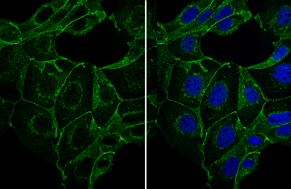 E-Cadherin antibody detects E-Cadherin protein at cell membrane by immunofluorescent analysis. Sample: MDCK cells were fixed in 4% paraformaldehyde at RT for 15 min. Green: E-Cadherin stained by E-Cadherin antibody (GTX124178) diluted at 1:1000.