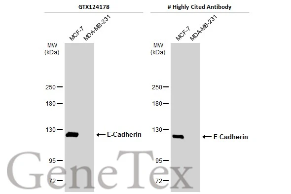 Various whole cell extracts (30 μg) were separated by 5% SDS-PAGE, and the membranes were blotted with E-Cadherin antibody [N3C2], Internal (GTX124178) diluted at 1:3000 and competitor's antibody diluted at 1:3000. The HRP-conjugated anti-rabbit IgG antibody (GTX213110-01) was used to detect the primary antibody. *The competitor is not affiliated with GeneTex and does not endorse this product.