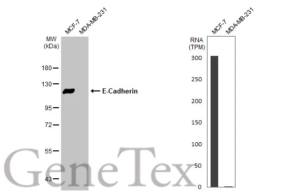Various whole cell extracts (30 μg) were separated by 7.5% SDS-PAGE, and the membrane was blotted with E-Cadherin antibody [N3C2], Internal (GTX124178) diluted at 1:3000. The HRP-conjugated anti-rabbit IgG antibody (GTX213110-01) was used to detect the primary antibody. Corresponding RNA expression data for the same cell lines are based on Human Protein Atlas program.