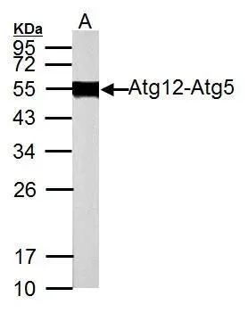 Sample (50 μg of whole cell lysate) A: Rat brain 12% SDS PAGE GTX124181 diluted at 1:1000 The HRP-conjugated anti-rabbit IgG antibody (GTX213110-01) was used to detect the primary antibody.