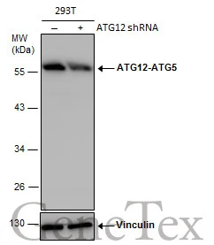 Non-transfected (–) and transfected (+) 293T whole cell extracts (30 μg) were separated by 10% SDS-PAGE, and the membrane was blotted with ATG12 antibody (GTX124181) diluted at 1:500. The HRP-conjugated anti-rabbit IgG antibody (GTX213110-01) was used to detect the primary antibody.