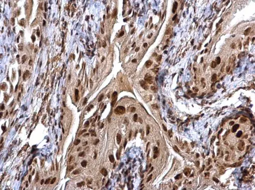 CHD4 antibody detects CHD4 protein at cytosol and nucleus on mouse urinary bladder by immunohistochemical analysis. Sample: Paraffin-embedded mouse urinary bladder. CHD4 antibody (GTX124186) dilution: 1:500. 
 Antigen Retrieval: Trilogy? (EDTA based, pH 8.0) buffer, 15min