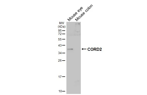 Various tissue extracts (50 μg) were separated by 12% SDS-PAGE, and the membrane was blotted with CORD2 antibody (GTX124188) diluted at 1:1000. The HRP-conjugated anti-rabbit IgG antibody (GTX213110-01) was used to detect the primary antibody.