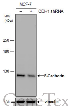 Non-transfected (–) and transfected (+) MCF-7 whole cell extracts (30 μg) were separated by 5% SDS-PAGE, and the membrane was blotted with E-Cadherin antibody (GTX124198) diluted at 1:1500.