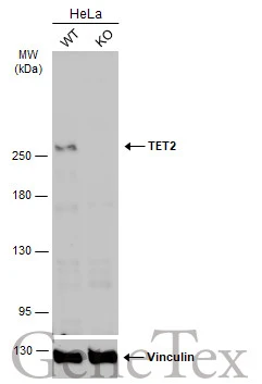 Wild-type (WT) and TET2 knockout (KO) HeLa cell extracts (30 μg) were separated by 5% SDS-PAGE, and the membrane was blotted with TET2 antibody [N2], N-term (GTX124204) diluted at 1:500. The HRP-conjugated anti-rabbit IgG antibody (GTX213110-01) was used to detect the primary antibody, and the signal was developed with Trident ECL plus-Enhanced.