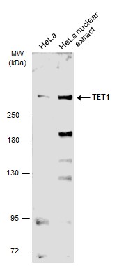 Various whole cell extracts (30 ug) were separated by 5% SDS-PAGE,and the membrane was blotted with TET1 antibody [N3C1] (GTX124207) diluted at 1:2000. The HRP-conjugated anti-rabbit IgG antibody (GTX213110-01) was used to detect the primary antibody.