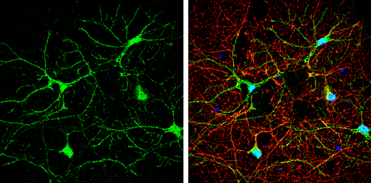 iNOS antibody [N1N2-2], N-term detects iNOS protein by immunofluorescent analysis. Sample: DIV10 rat E18 primary cortical neuron and glia cells were fixed in 4% paraformaldehyde at RT for 15 min. Green: iNOS stained by iNOS antibody [N1N2-2], N-term (GTX124210) diluted at 1:500. Red: beta Tubulin 3/ Tuj1, stained by beta Tubulin 3/ Tuj1 antibody [GT11710] (GTX631836) diluted at 1:1000. Blue: Fluoroshield with DAPI (GTX30920).