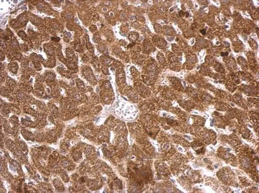 iNOS antibody [N1N2-2],N-term detects iNOS protein at cytosol on mouse liver by immunohistochemical analysis.