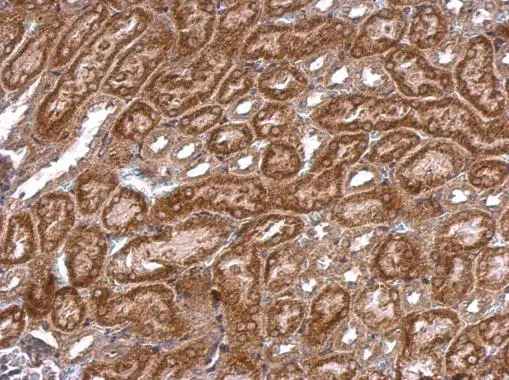 iNOS antibody [N1N2-2], N-term detects iNOS protein at cytosol on mouse kidney by immunohistochemical analysis. Sample: Paraffin-embedded mouse kidney. iNOS antibody [N1N2-2], N-term (GTX124210) dilution: 1:500. 
 Antigen Retrieval: Trilogy? (EDTA based, pH 8.0) buffer, 15min