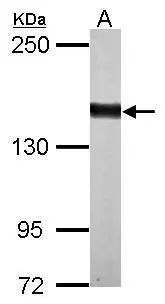 Sample (50 ug of whole cell lysate) A: mouse liver 5% SDS PAGE GTX124219 diluted at 1:1000