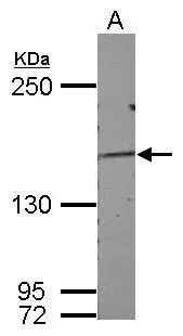 Sample (50 ug of whole cell lysate) A: mouse kidney 5% SDS PAGE GTX124220 diluted at 1:500