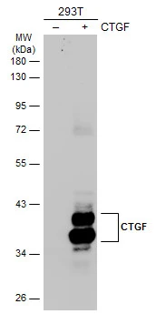 Anti-CTGF antibody (GTX124232) | GeneTex