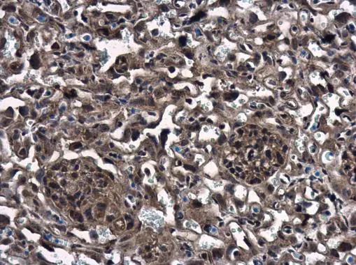 CTGF antibody