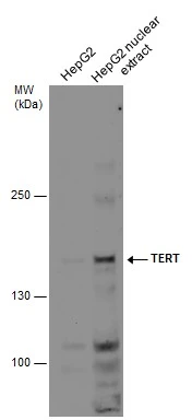HepG2 whole cell and nuclear extracts (30 μg) were separated by 5% SDS-PAGE, and the membrane was blotted with TERT antibody [C2C3-2], C-term (GTX124242) diluted at 1:500.