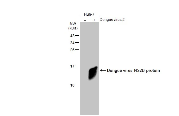 Non-infected (–) and infected (+) Huh-7 whole cell extracts (15 μg) were separated by 15% SDS-PAGE, and the membrane was blotted with Dengue virus NS2B protein antibody (GTX124246) diluted at 1:1000. The HRP-conjugated anti-rabbit IgG antibody (GTX213110-01) was used to detect the primary antibody.