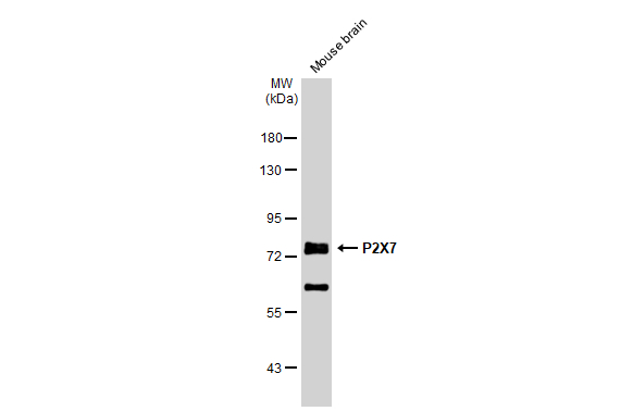 Mouse tissue extract (50 μg) was separated by 7.5% SDS-PAGE, and the membrane was blotted with P2X7 antibody [C3], C-term (GTX124256) diluted at 1:1000. The HRP-conjugated anti-rabbit IgG antibody (GTX213110-01) was used to detect the primary antibody.