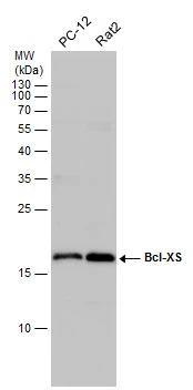 Various whole cell extracts (30 μg) were separated by 15% SDS-PAGE, and the membrane was blotted with Bcl-XS antibody (GTX124266) diluted at 1:1000. Various whole cell extracts (30 μg) were separated by 15% SDS-PAGE, and the membrane was blotted with Bcl-XS antibody (GTX124266) diluted at 1:1000.