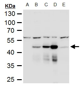 Immunofluorescence analysis of paraformaldehyde-fixed BHK-21 cell,using NS1 (Dengue virus 2)(GTX124280) antibody at 1:2000 dilution.