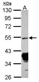 Rxraa+b antibody