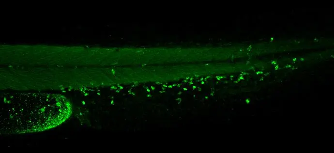 Anti-Lcp1 antibody (GTX124420) | GeneTex Anti-Lcp1 antibody (GTX124420) | GeneTex