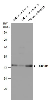 Various tissue extracts (30 ug) were separated by 10% SDS-PAGE,and the membrane was blotted with Bactin1 antibody (GTX124500) diluted at 1:1000.