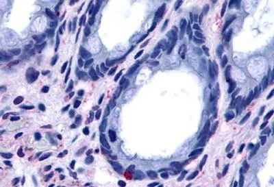 IHC-P analysis of human colon tissue using GTX12543 GPR15 antibody. Antigen retrieval : Heat-induced antigen retrieval