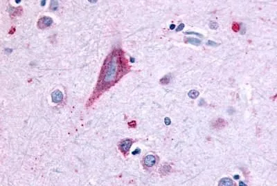 IHC-P analysis of brain, amygdala, neurons and glia tissue using GTX12571 GPR43 antibody. IHC-P analysis of brain, amygdala, neurons and glia tissue using GTX12571 GPR43 antibody.