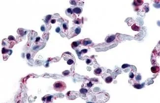 IHC-P analysis of human lung tissue using GTX12571 GPR43 antibody. Antigen retrieval : Heat-induced antigen retrieval