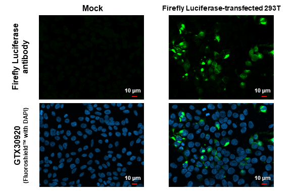 Infiltrate NF 3枚　Fab Anti-Firefly Luciferase antibody (GTX125849) | GeneTex