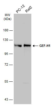Various whole cell extracts (30 μg) were separated by 7.5% SDS-PAGE, and the membrane was blotted with GEF-H1 antibody (GTX125893) diluted at 1:500. The HRP-conjugated anti-rabbit IgG antibody (GTX213110-01) was used to detect the primary antibody. Various whole cell extracts (30 μg) were separated by 7.5% SDS-PAGE, and the membrane was blotted with GEF-H1 antibody (GTX125893) diluted at 1:500. The HRP-conjugated anti-rabbit IgG antibody (GTX213110-01) was used to detect the primary antibody.