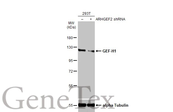 Non-transfected (–) and transfected (+) 293T whole cell extracts (30 μg) were separated by 7.5% SDS-PAGE, and the membrane was blotted with GEF-H1 antibody (GTX125893) diluted at 1:4000. The HRP-conjugated anti-rabbit IgG antibody (GTX213110-01) was used to detect the primary antibody. Non-transfected (–) and transfected (+) 293T whole cell extracts (30 μg) were separated by 7.5% SDS-PAGE, and the membrane was blotted with GEF-H1 antibody (GTX125893) diluted at 1:4000. The HRP-conjugated anti-rabbit IgG antibody (GTX213110-01) was used to detect the primary antibody.