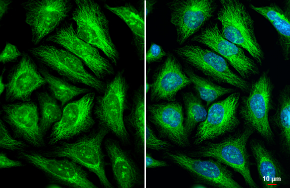 GEF-H1 antibody detects GEF-H1 protein at cytoskeleton and Golgi apparatus by immunofluorescent analysis. Sample: HeLa cells were fixed in ice-cold MeOH for 5 min. Green: GEF-H1 stained by GEF-H1 antibody (GTX125893) diluted at 1:500. Blue: Hoechst 33342 staining. Scale bar= 10 μm. GEF-H1 antibody detects GEF-H1 protein at cytoskeleton and Golgi apparatus by immunofluorescent analysis. Sample: HeLa cells were fixed in ice-cold MeOH for 5 min. Green: GEF-H1 stained by GEF-H1 antibody (GTX125893) diluted at 1:500. Blue: Hoechst 33342 staining. Scale bar= 10 μm.