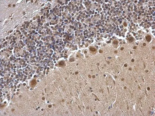 USP7 antibody detects USP7 protein at cytosol and nucleus on mouse hind brain by immunohistochemical analysis. Sample: Paraffin-embedded mouse hind brain. USP7 antibody (GTX125894) dilution: 1:500. 
 Antigen Retrieval: Trilogy? (EDTA based, pH 8.0) buffer, 15min