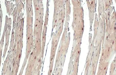 USP7 antibody detects USP7 protein at cytoplasm and nucleus by immunohistochemical analysis. Sample: Paraffin-embedded mouse heart. USP7 stained by USP7 antibody (GTX125894) diluted at 1:500. Antigen Retrieval: Citrate buffer, pH 6.0, 15 min