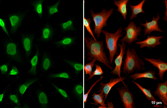 USP7 antibody detects USP7 protein at nucleus by immunofluorescent analysis. Sample: HeLa cells were fixed in 4% paraformaldehyde at RT for 15 min. Green: USP7 stained by USP7 antibody (GTX125894) diluted at 1:500. Red: alpha Tubulin, a cytoskeleton marker, stained by alpha Tubulin antibody [GT114] (GTX628802) diluted at 1:1000. Blue: Fluoroshield with DAPI (GTX30920). Scale bar= 10μm.