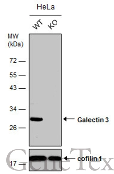 Wild-type (WT) and Galectin 3 knockout (KO) HeLa cell extracts (30 μg) were separated by 12% SDS-PAGE, and the membrane was blotted with Galectin 3 antibody (GTX125897) diluted at 1:500. The HRP-conjugated anti-rabbit IgG antibody (GTX213110-01) was used to detect the primary antibody, and the signal was developed with Trident ECL plus-Enhanced. Wild-type (WT) and Galectin 3 knockout (KO) HeLa cell extracts (30 μg) were separated by 12% SDS-PAGE, and the membrane was blotted with Galectin 3 antibody (GTX125897) diluted at 1:500. The HRP-conjugated anti-rabbit IgG antibody (GTX213110-01) was used to detect the primary antibody, and the signal was developed with Trident ECL plus-Enhanced.