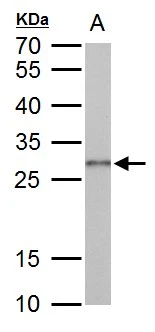 Galectin3 antibody detects Galectin3 protein by western blot analysis. A. 50 μg rat colon lysate/extract 12 % SDS-PAGE Galectin3 antibody (GTX125897) dilution: 1:1000