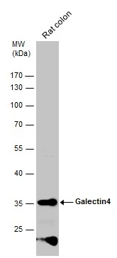 Rat tissue extract (50 μg) was separated by 10% SDS-PAGE, and the membrane was blotted with Galectin4 antibody (GTX125898) diluted at 1:5000. The HRP-conjugated anti-rabbit IgG antibody (GTX213110-01) was used to detect the primary antibody.
