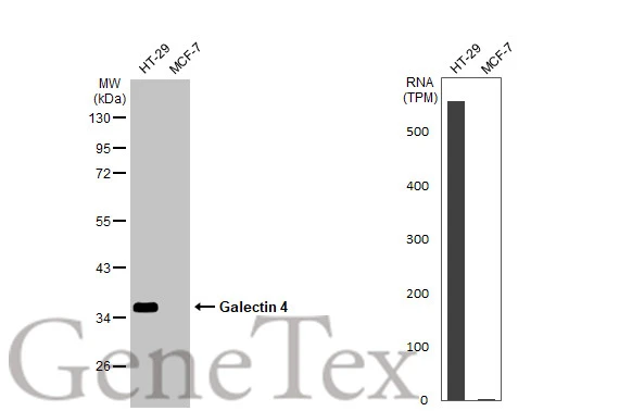 Various whole cell extracts (30 μg) were separated by 10% SDS-PAGE, and the membrane was blotted with Galectin 4 antibody (GTX125898) diluted at 1:1000. The HRP-conjugated anti-rabbit IgG antibody (GTX213110-01) was used to detect the primary antibody. Corresponding RNA expression data for the same cell lines are based on Human Protein Atlas program.