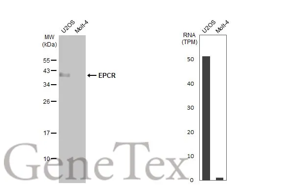 Various whole cell extracts (30 μg) were separated by 12% SDS-PAGE, and the membrane was blotted with EPCR antibody (GTX125912) diluted at 1:5000. The HRP-conjugated anti-rabbit IgG antibody (GTX213110-01) was used to detect the primary antibody. Corresponding RNA expression data for the same cell lines are based on Human Protein Atlas program.