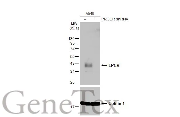 Non-transfected (–) and transfected (+) A549 whole cell extracts (30 μg) were separated by 12% SDS-PAGE, and the membrane was blotted with EPCR antibody (GTX125912) diluted at 1:5000. The HRP-conjugated anti-rabbit IgG antibody (GTX213110-01) was used to detect the primary antibody. Non-transfected (–) and transfected (+) A549 whole cell extracts (30 μg) were separated by 12% SDS-PAGE, and the membrane was blotted with EPCR antibody (GTX125912) diluted at 1:5000. The HRP-conjugated anti-rabbit IgG antibody (GTX213110-01) was used to detect the primary antibody.