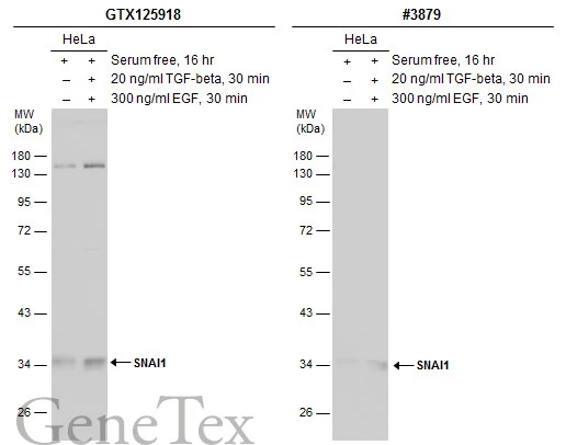 Untreated (–) and treated (+) HeLa whole cell extracts (50 μg) were separated by 10% SDS-PAGE, and the membranes were blotted with SNAI1 antibody (GTX125918) diluted at 1:1000 and competitor's antibody (#3879) diluted at 1:1000. The HRP-conjugated anti-rabbit IgG antibody (GTX213110-01) was used to detect the primary antibody, and the signal was developed with Trident ECL plus-Enhanced. *The competitor is not affiliated with GeneTex and does not endorse this product.