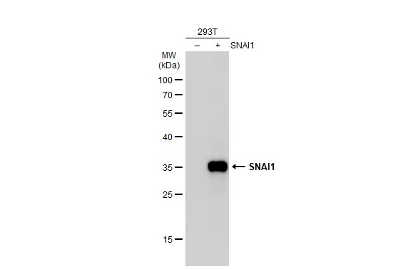 Anti-SNAI1 antibody (GTX125918) | GeneTex