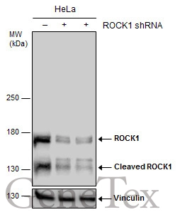 Non-transfected (–) and transfected (+) HeLa whole cell extracts (30 μg) were separated by 5% SDS-PAGE, and the membrane was blotted with ROCK1 antibody (GTX125921) diluted at 1:500.