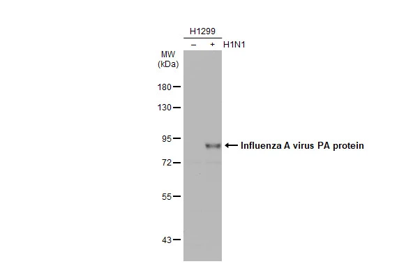 Non-infected (�) and infected (+) H1299 whole cell extracts (30 ug) were separated by 7.5% SDS-PAGE,and the membrane was blotted with Influenza A virus PA protein antibody (GTX125932) diluted at 1:5000.