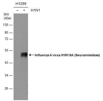 Rabbit Polyclonal Anti-FAM13A Antibody - Buy for research