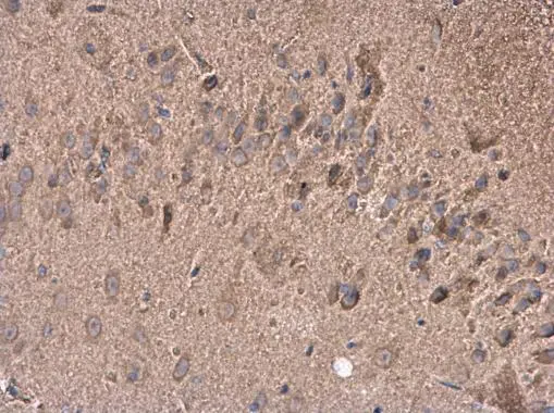 GABA antibody